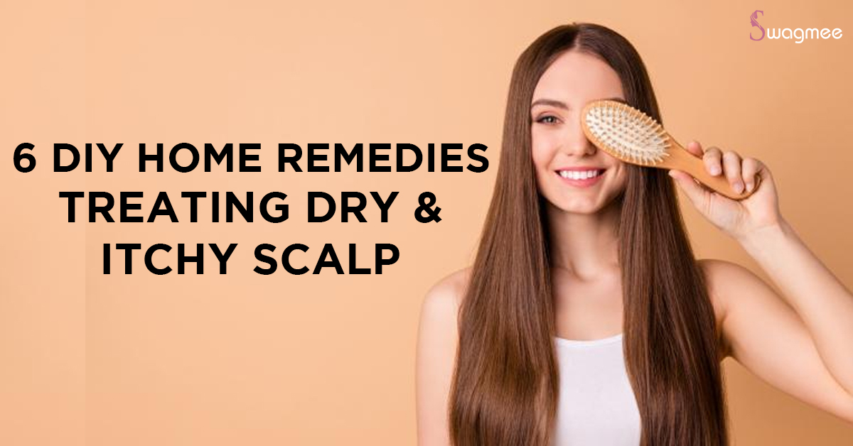 6 DIY Home Remedies For Treating Dry & Itchy Scalp